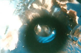 Model 5 